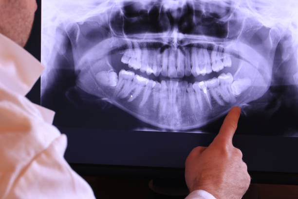 Best Weekend Emergency Dentist in Marion, WI