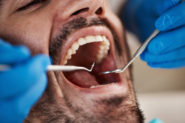 Best Walk-In Emergency Dentist in Marion, WI